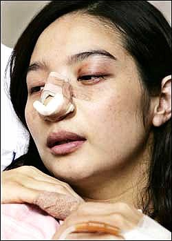 夫にボコボコにされ鼻を折られ流産した韓国の女優