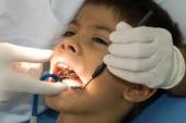 pediatric dent##