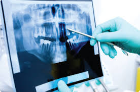 dental radiology